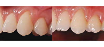 960x435-flexipaletteb1