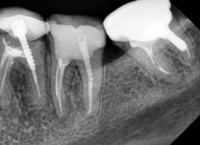 6d621471111b929bbdb87202558bef90