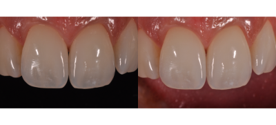 960x435-flexipalettea